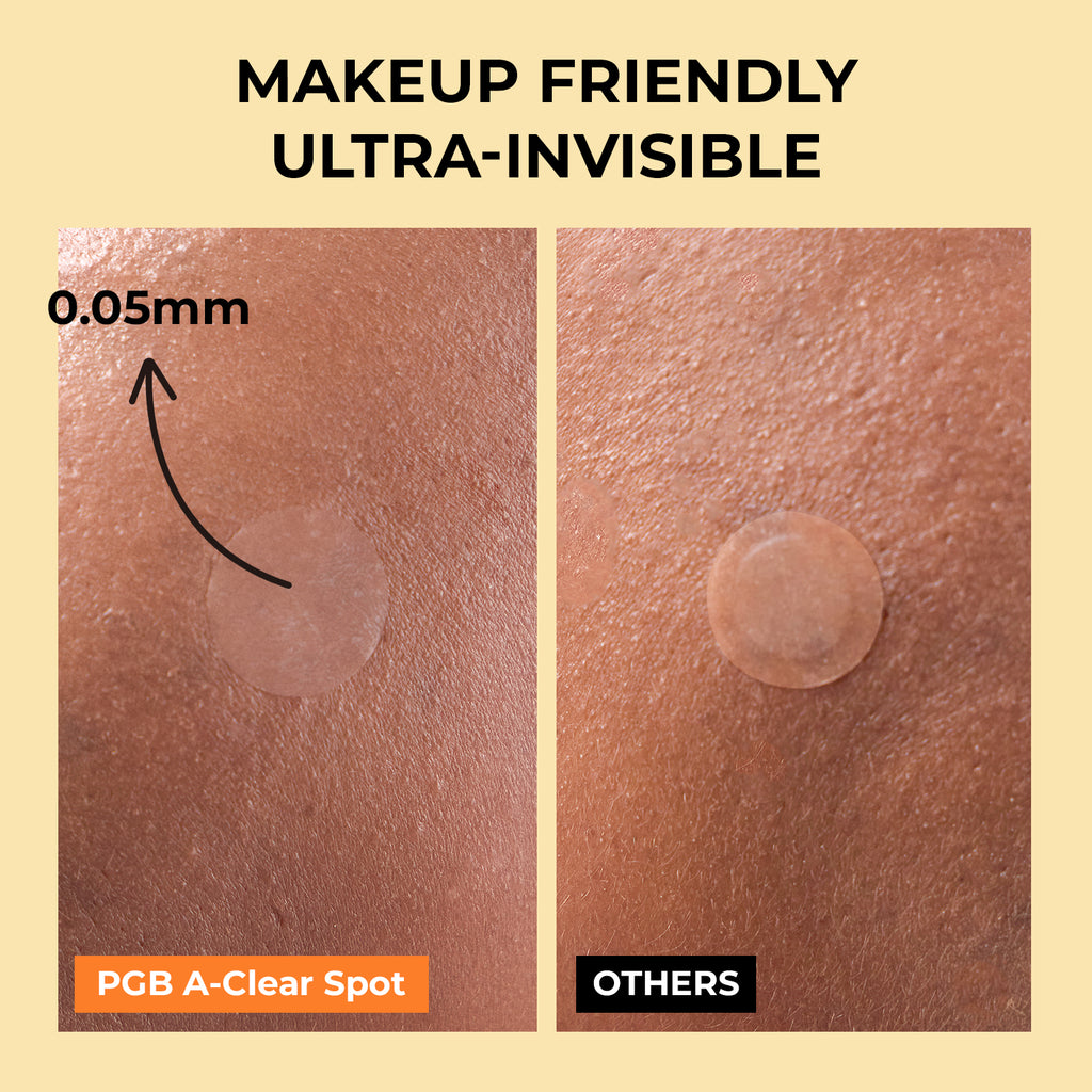 [PGB]A-Clear Spot Patch(Day/Night)-58counts